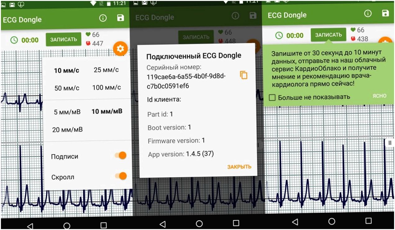 Обзор "кардиофлешки" ECG Dongle: сердечный контроль