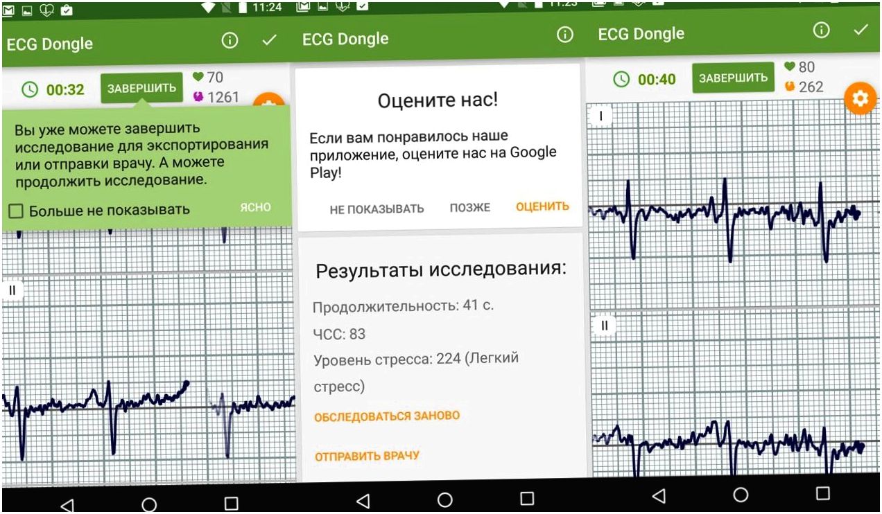 Обзор "кардиофлешки" ECG Dongle: сердечный контроль