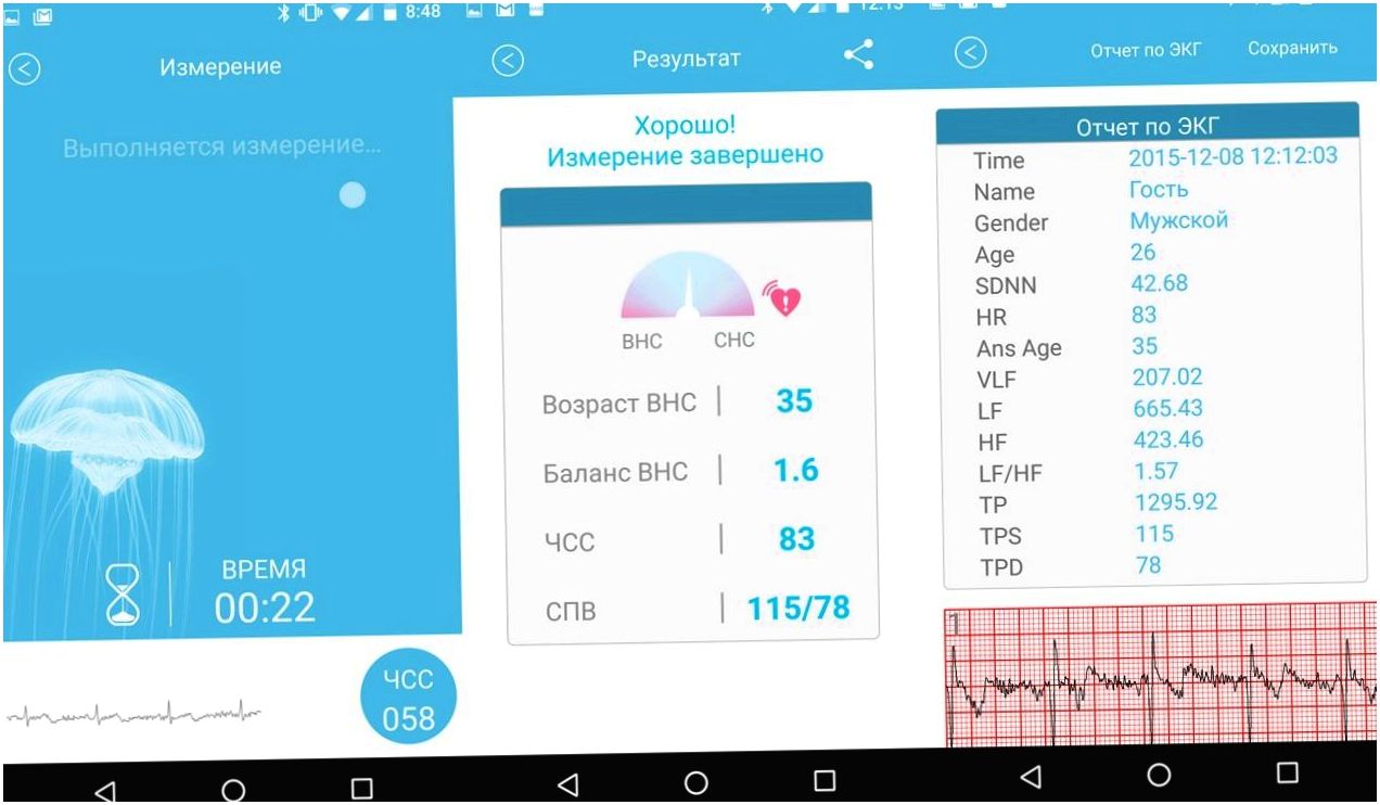 Обзор биодатчика Rooti W/Me2: медбрат на запястье (обзор, биодатчика, rooti, медбрат, запястье, кровяное давление) Обзор биодатчика Rooti W/Me2: медбрат на запястье
